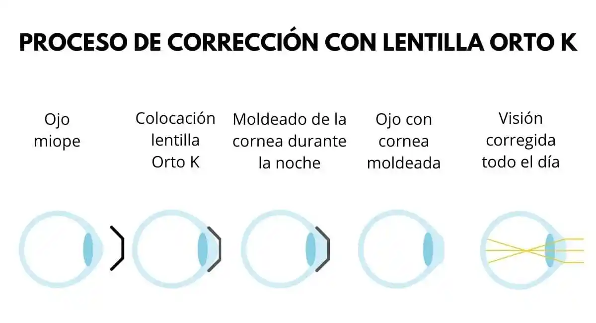 kit activa tu vision