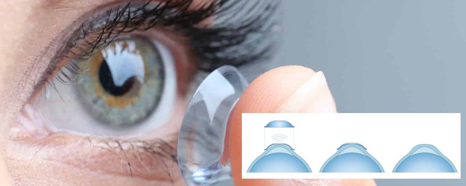 lentes orto-k en Córdoba